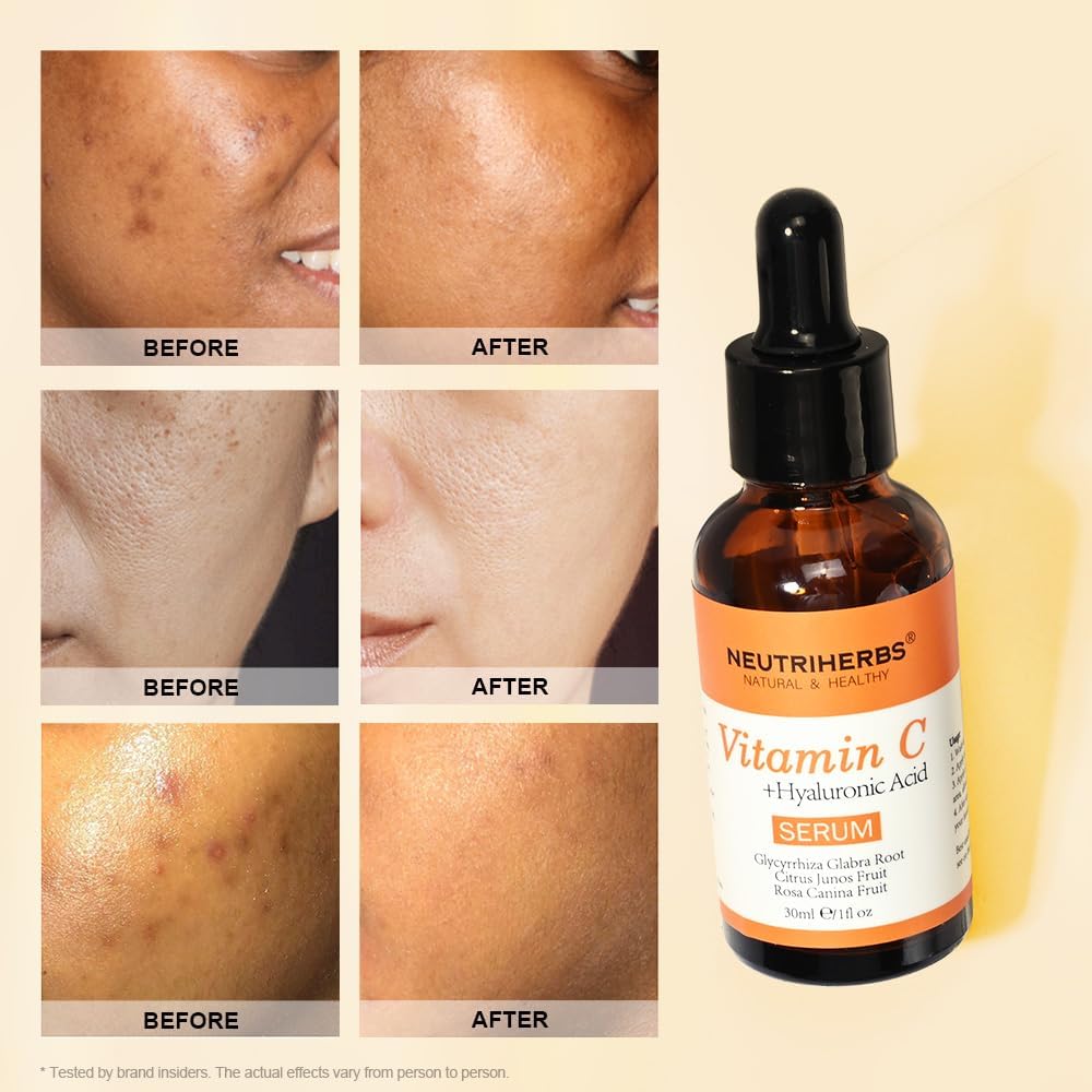 Neutriherbs Vitamin C Face Serum | Anti-Aging + Brightening | Hyaluronic Acid + Collagen | Glowing Skin Daily Care
