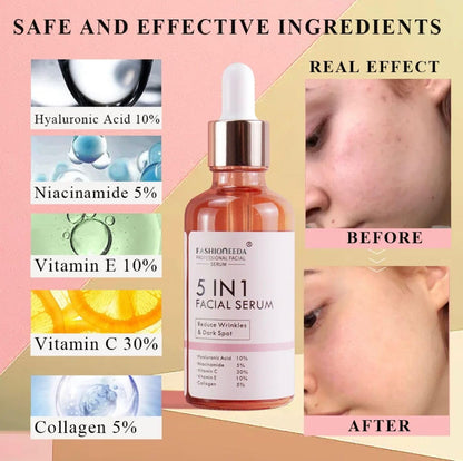 Vitamin C Serum for Face | Anti Aging Serum with Hyaluronic Acid, Vitamin E | 5 in 1 Face Brightening Serum for Dark Spots, Fine Lines and Wrinkles,30ml