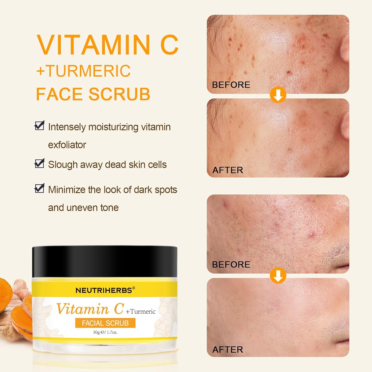 NEUTRIHERBS Turmeric Face Scrub | Exfoliating Scrub Cream with Vitamin C - 1.76oz
